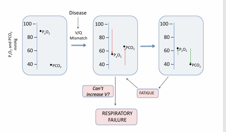 <p>-severe disease</p>