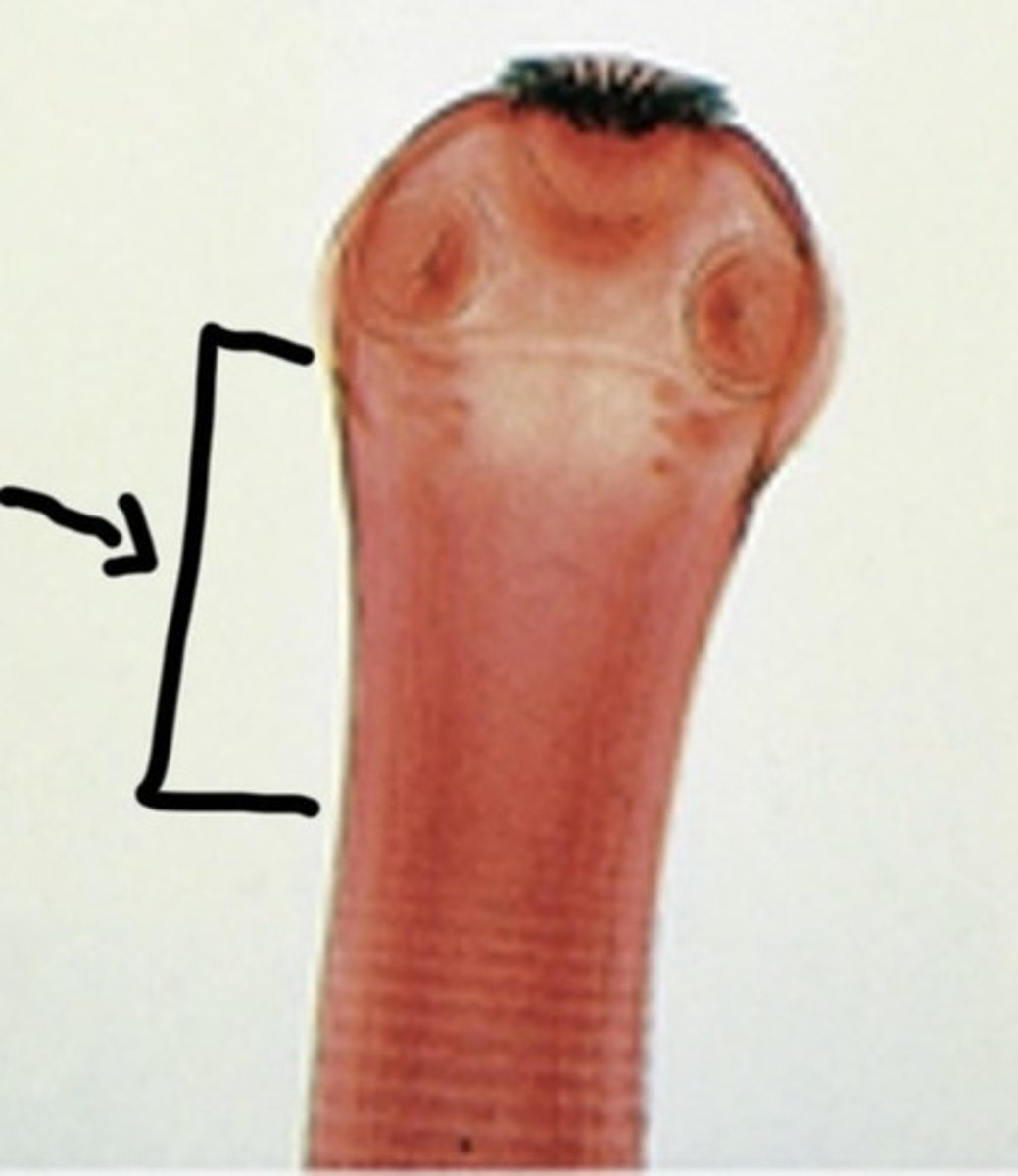 <p>What is this pointing to?</p>