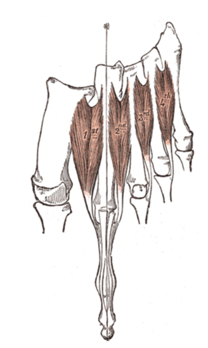 <p>ulnar</p>