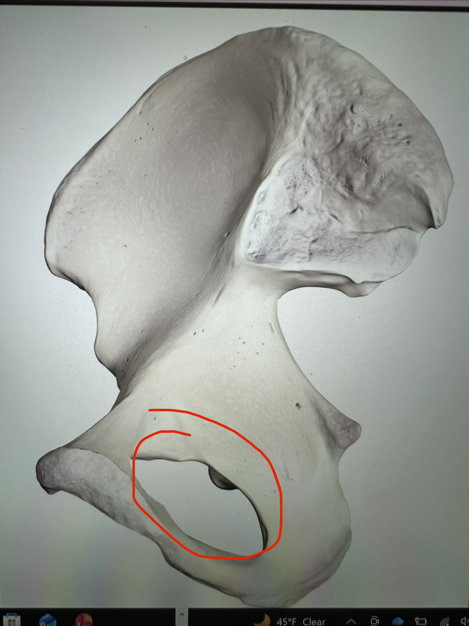 <p>os coxae, big hole</p>