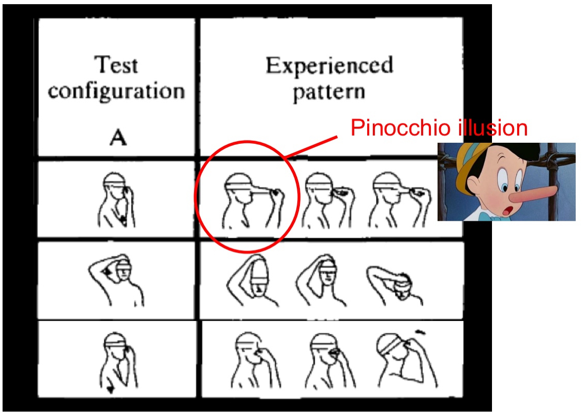 <ul><li><p>actually a multisensory illusion</p></li><li><p>A&nbsp;<strong>vibration</strong>&nbsp;is applied to the&nbsp;<strong>biceps tendon</strong>&nbsp;while a person is&nbsp;<strong>touching their nose with their finger</strong>, eyes closed.</p></li><li><p>The vibration stimulates&nbsp;<strong>muscle spindle receptors</strong>, just like in the first proprioceptive illusion.</p></li><li><p>This creates the&nbsp;<strong>illusion that the arm is extending</strong>&nbsp;—&nbsp;<strong>even though it’s not</strong>.</p></li><li><p>However, since the fingertip is&nbsp;<strong>still in contact with the nose</strong>, the brain tries to make sense of these&nbsp;<strong>conflicting signals</strong>: If the arm feels like it’s extending, but the finger is still touching the nose... then maybe the&nbsp;nose is growing!</p></li><li><p>The result: The person&nbsp;<strong>feels like their nose is getting longer</strong>&nbsp;— hence the name&nbsp;<strong>"Pinocchio Illusion."</strong></p></li></ul><p></p>