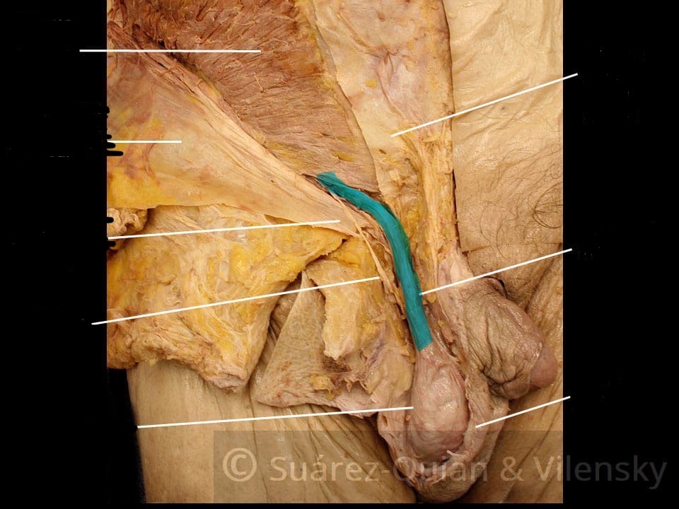 <p>What is the name of this highlighted structure ?</p>