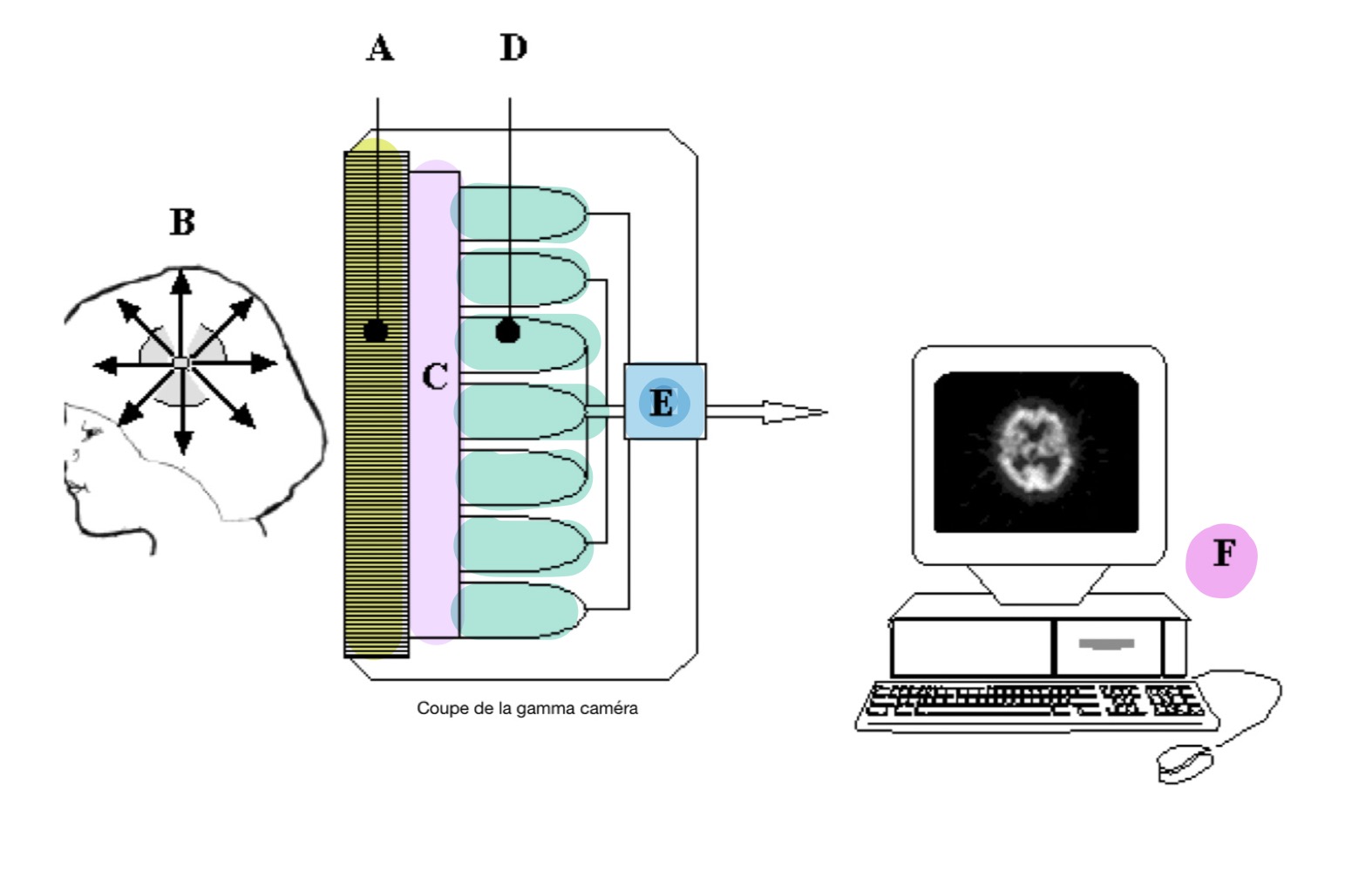 <p>Même principe que la scintigraphie à balayage mais avec quelques ajustements :</p><p>1) Plusieurs collimateurs parallèles l’une à l’autre (Permettant d’étudier simultanément l’activité d’une zone dont la surface est équivalente à celle du cristal).</p><p>2) Plusieurs dizaines de photomultiplicateurs (PM) disposés en réseau.</p><p>3) Un calculateur numérique → Reçoit les signaux électriques fournit par les PM et compare les intensités lumineuses détectées par chaque PM &amp; calcule l’énergie du photon incident.</p><p>4) Un écran vidéo (Image 2D)</p>