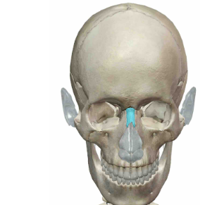 <p>What Facial Bone is this?</p>