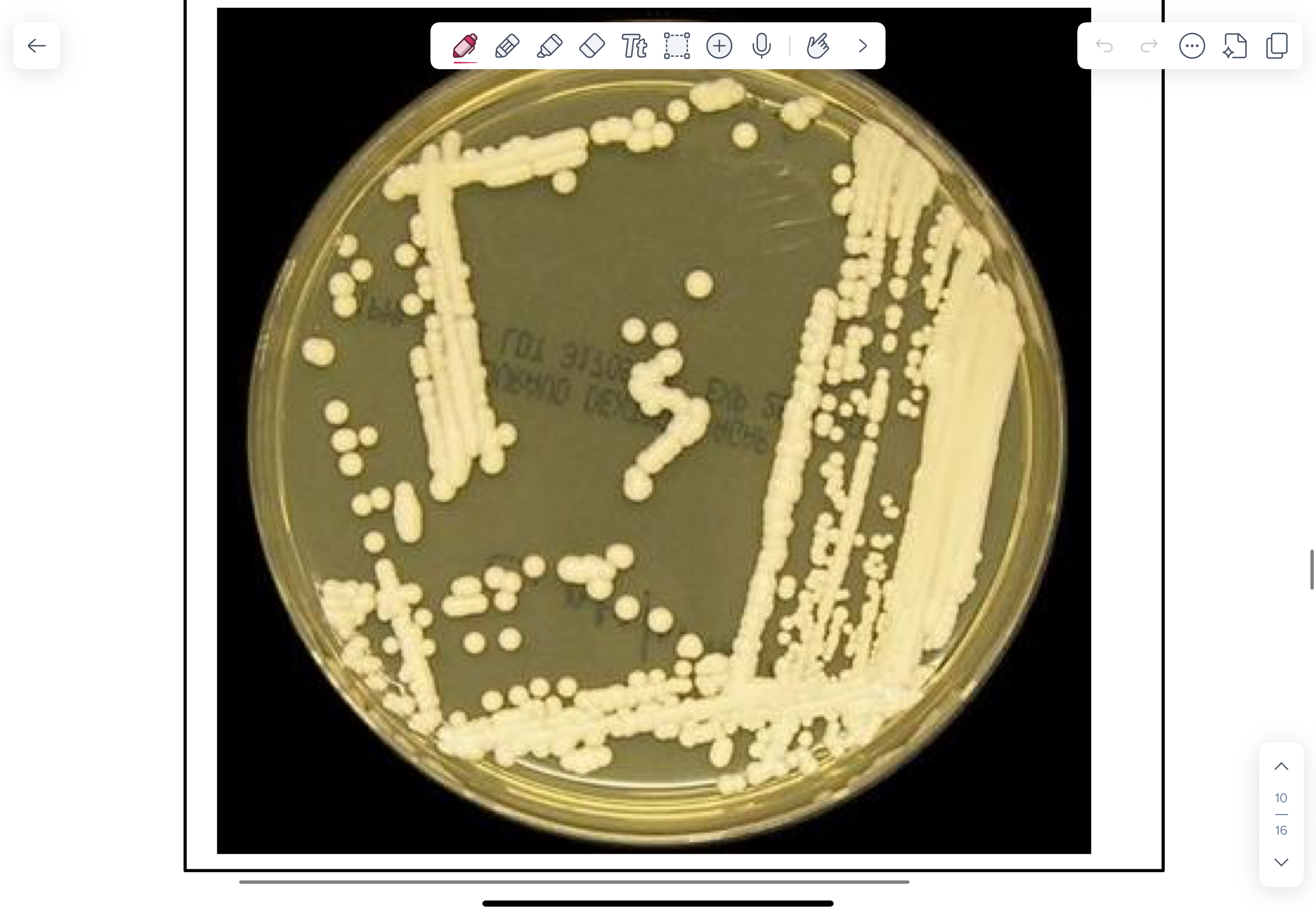 <p>Small, mucoid, cream-coloured colonies.</p>