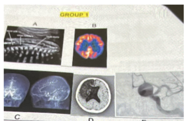 <p>Which is the PET scan? (use group 1 of photos)</p>