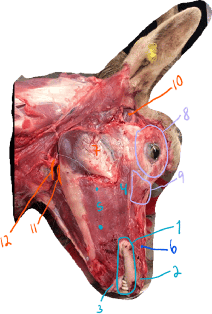 <p>(another view)<br>- what are the muscles here?</p>