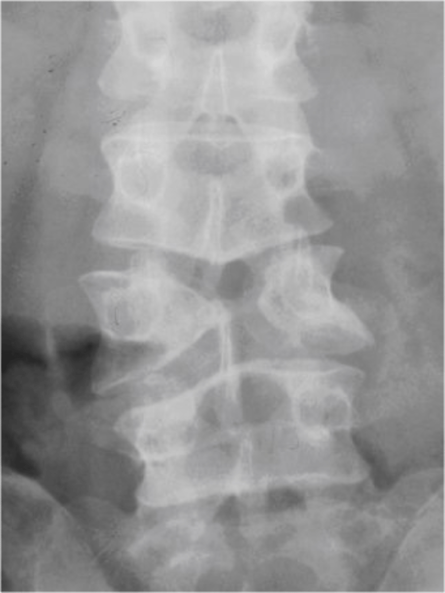 <p>Describe findings</p>