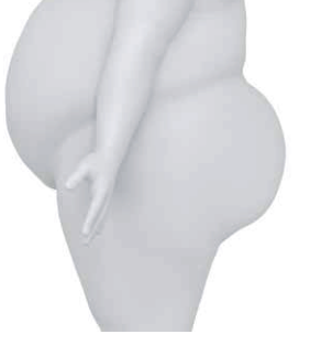 <p>What is the body type of Gluteal shelf?</p>