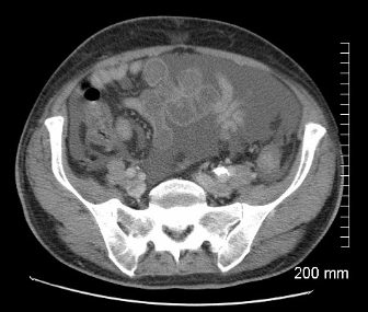 <p>Name the pathology</p>