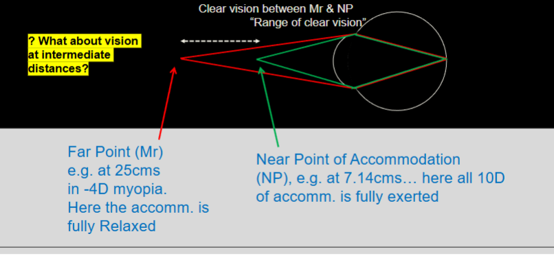 <p>the far point at 25cm is where there is no accomodation </p><p>at the near point of 7.14cm all 10D of accomodation is being used </p><p>clear vision is between the far point and the near point </p>