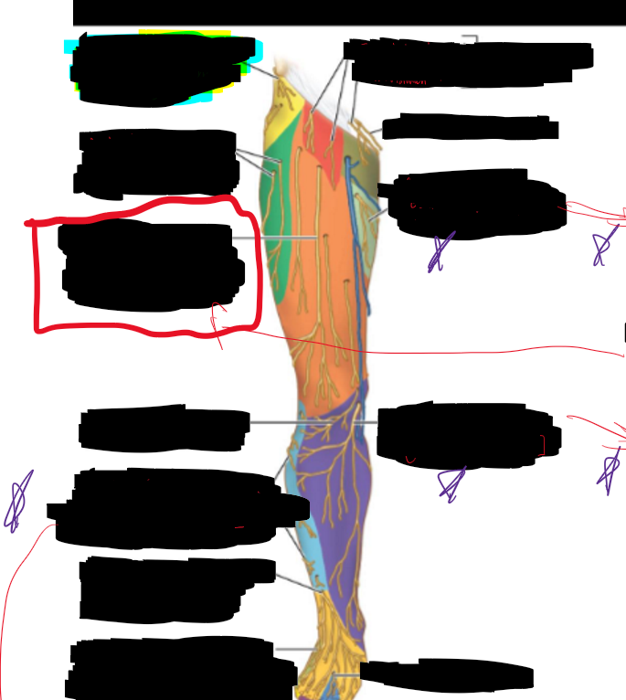 <p>What is the structure circled?</p>