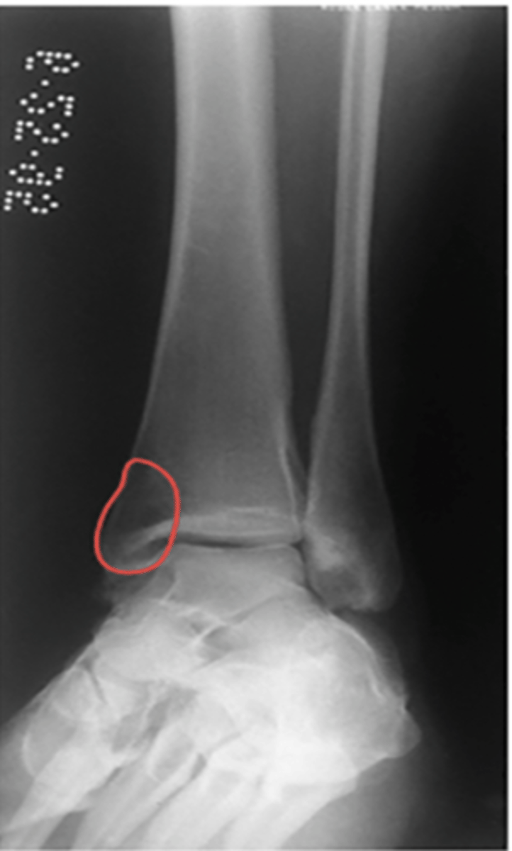 <p>What structure is highlighted?</p>