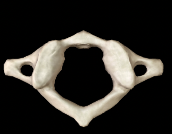 <p>Which bone is this?</p>