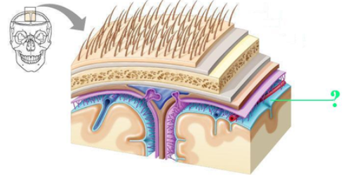 <p><span><span>Identify the indicated groove.</span></span></p>