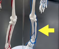 <p>Name the blood vessel.</p>