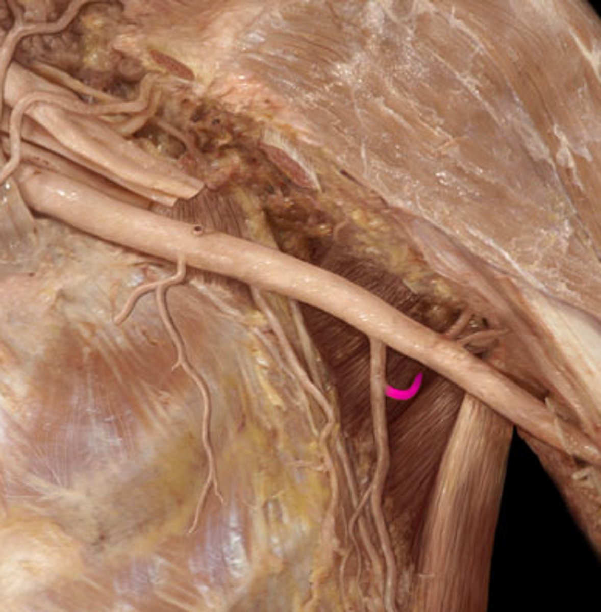 <p>comes off the subscapular artery, in the triangular space</p>