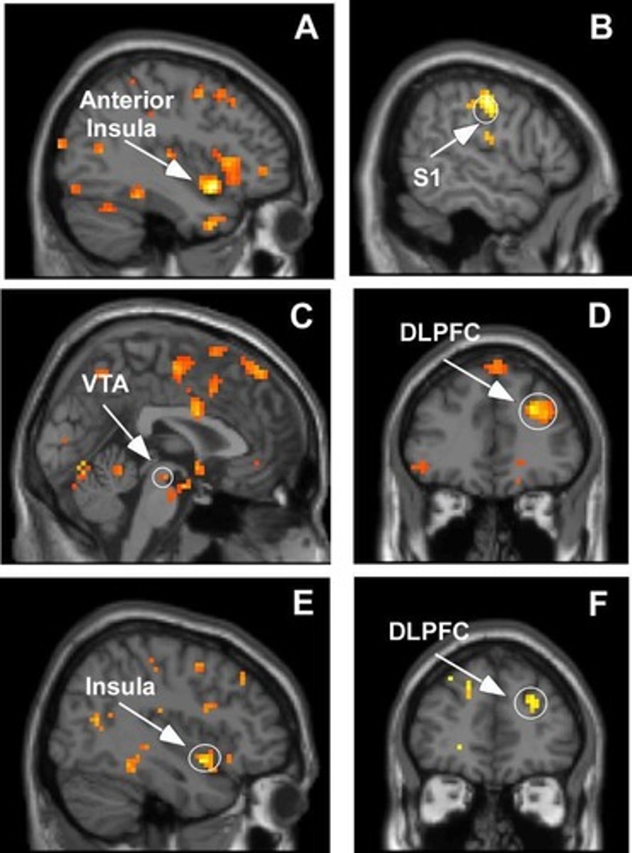 <p>Electroencephalography; records electrical activity of the brain.</p>