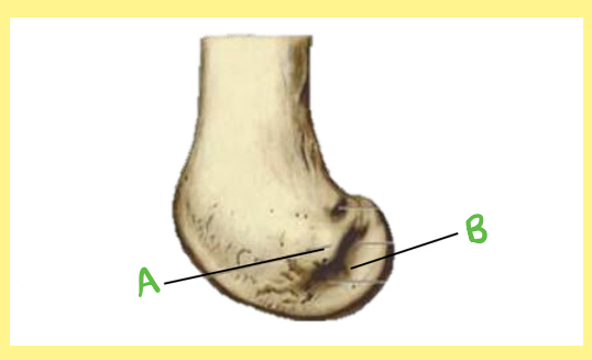 <p><u>Name the following</u>:</p><ul><li><p>Bone?</p></li><li><p>Side?</p></li><li><p>View?</p></li><li><p>B?</p></li></ul><p></p>