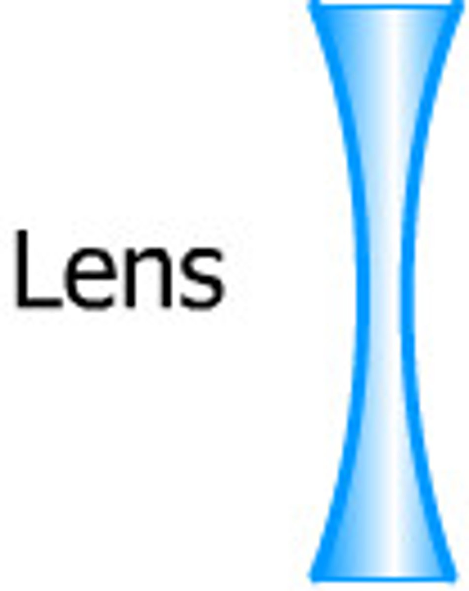 <p>What kind of lens is this?</p>