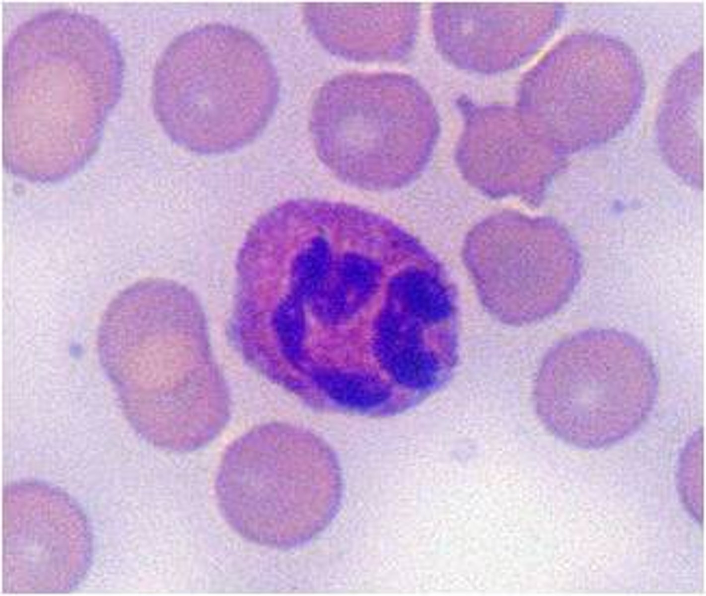 <p>heterophil (their lymphocyte)</p>