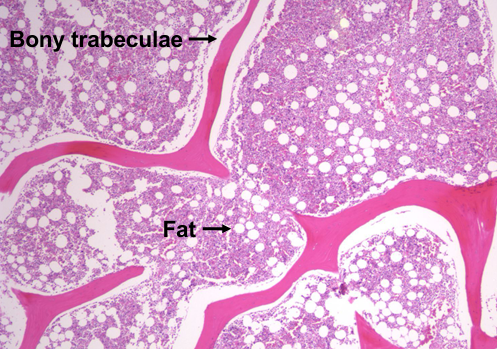 <p>bone marrow</p>