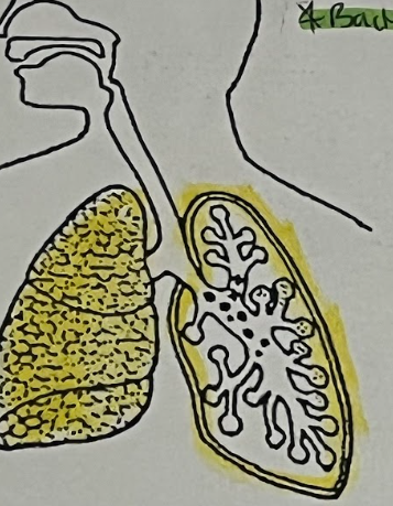 <p>Lung</p>