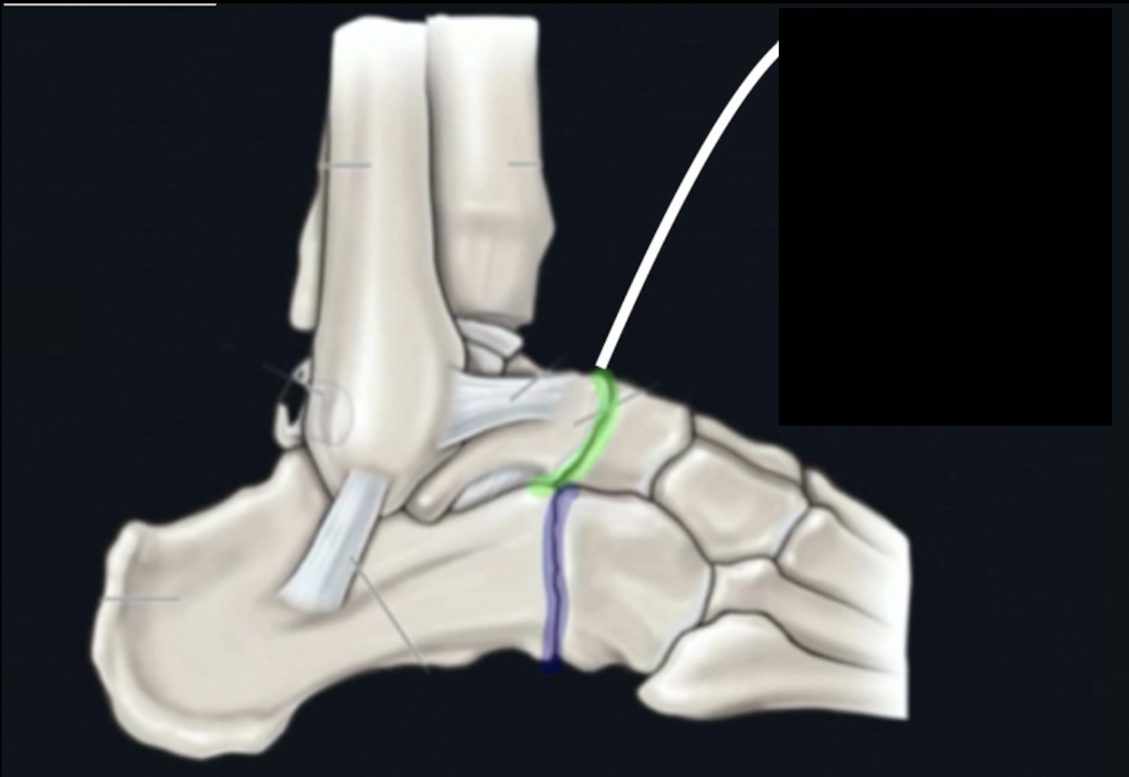 <p>What is this joint? </p>
