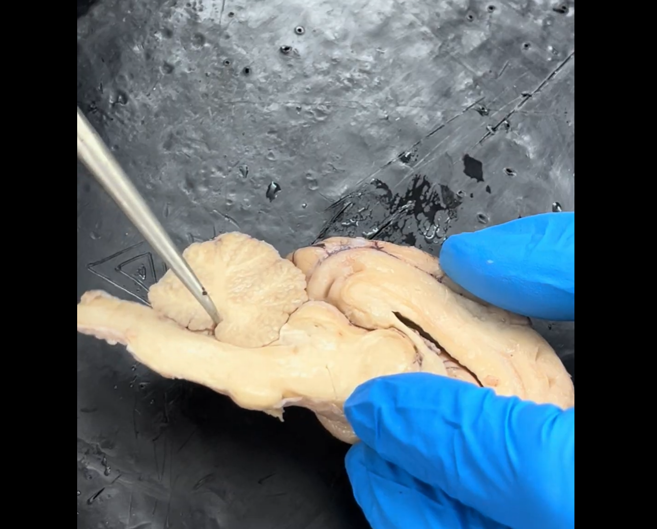 <p>Name the groove that the tip of the probe is in.</p>