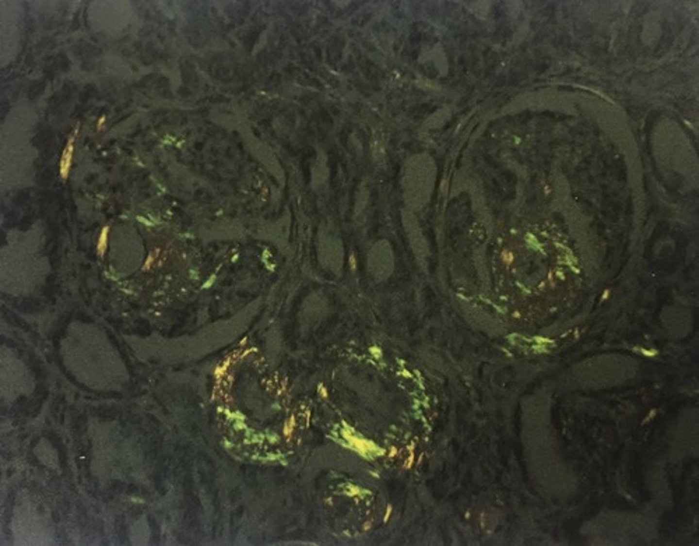 <p>Useful in specialized medical and industrial</p><p>Diagnosing amyloid stained with congo red</p><p>Identifying crystals such as talc, silica, and urates</p>