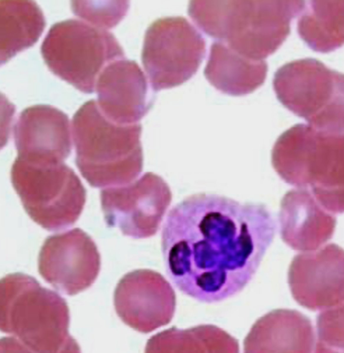 <p>Which leukocyte?</p>