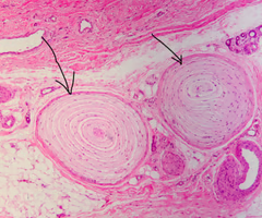 <p>pressure receptors</p>