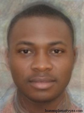 <p>Identify this Phenotype</p>