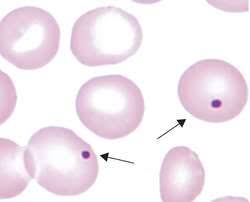 <p>Identify this type of red cell.</p>