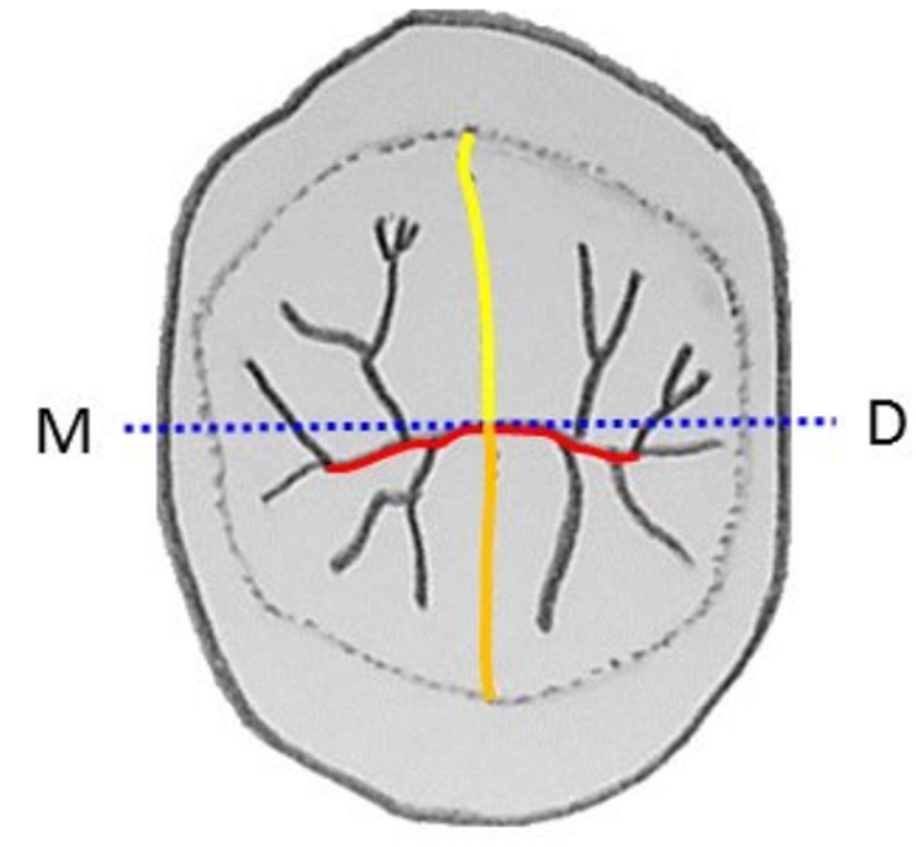 <p>- small pinpoint depression</p><p>- found at bottom of the central fossa (central pit)</p><p>OR</p><p>- at the bottom of the mesial and distal triangular fossae (mesial &amp; distal pits)</p>