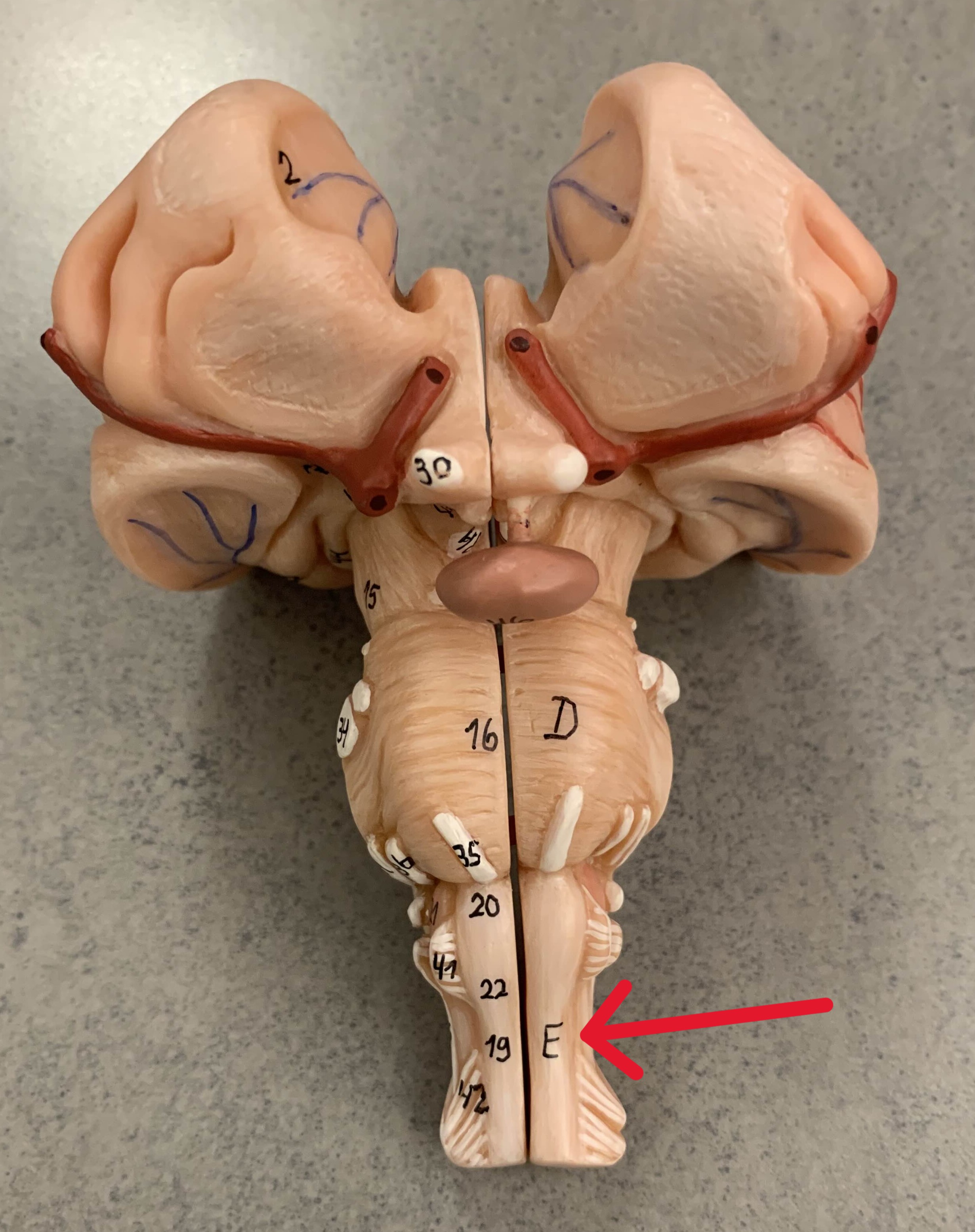 <p>Which part of the brain is:</p><ul><li><p>Lower brainstem</p></li><li><p>Inferior to pons</p></li></ul><p></p>