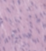 <p>Which type of tissue does this image depict?</p>