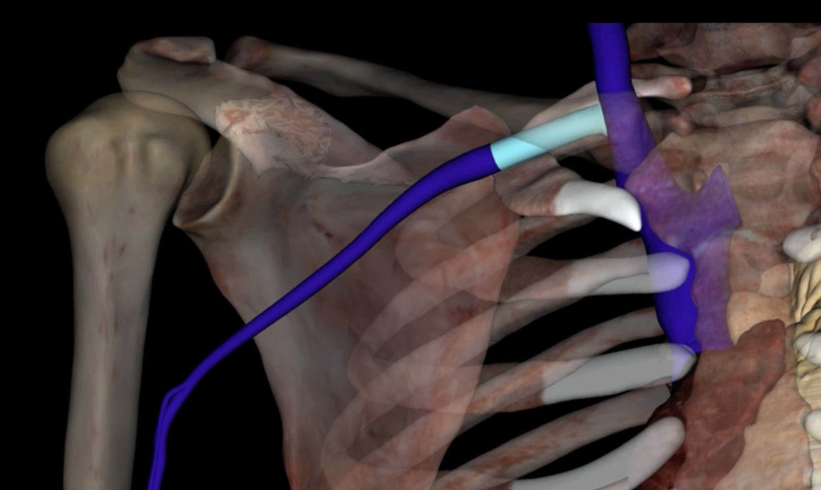 <p>What is highlighted in blue?</p>