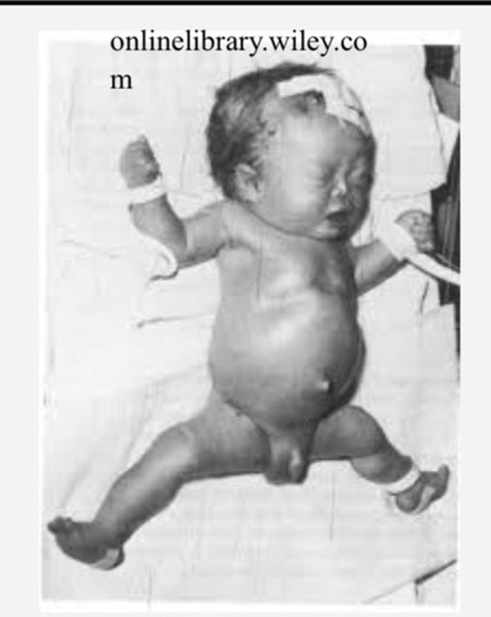 <p>Hint: look at nose too</p>