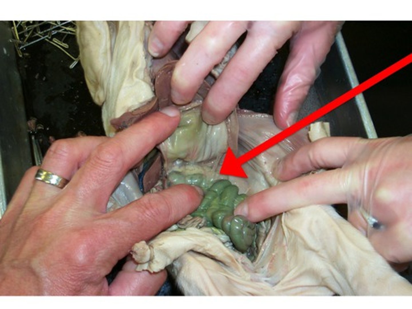 <p>An organs in the abdominal cavity with two roles. The first is an exocrine role: to produce digestive enzymes and bicarbonate, which are delivered to the small intestine via the pancreatic duct. The second is an endocrine role: to secrete insulin and glucagon into the bloodstream to help regulate blood glucose levels.</p>