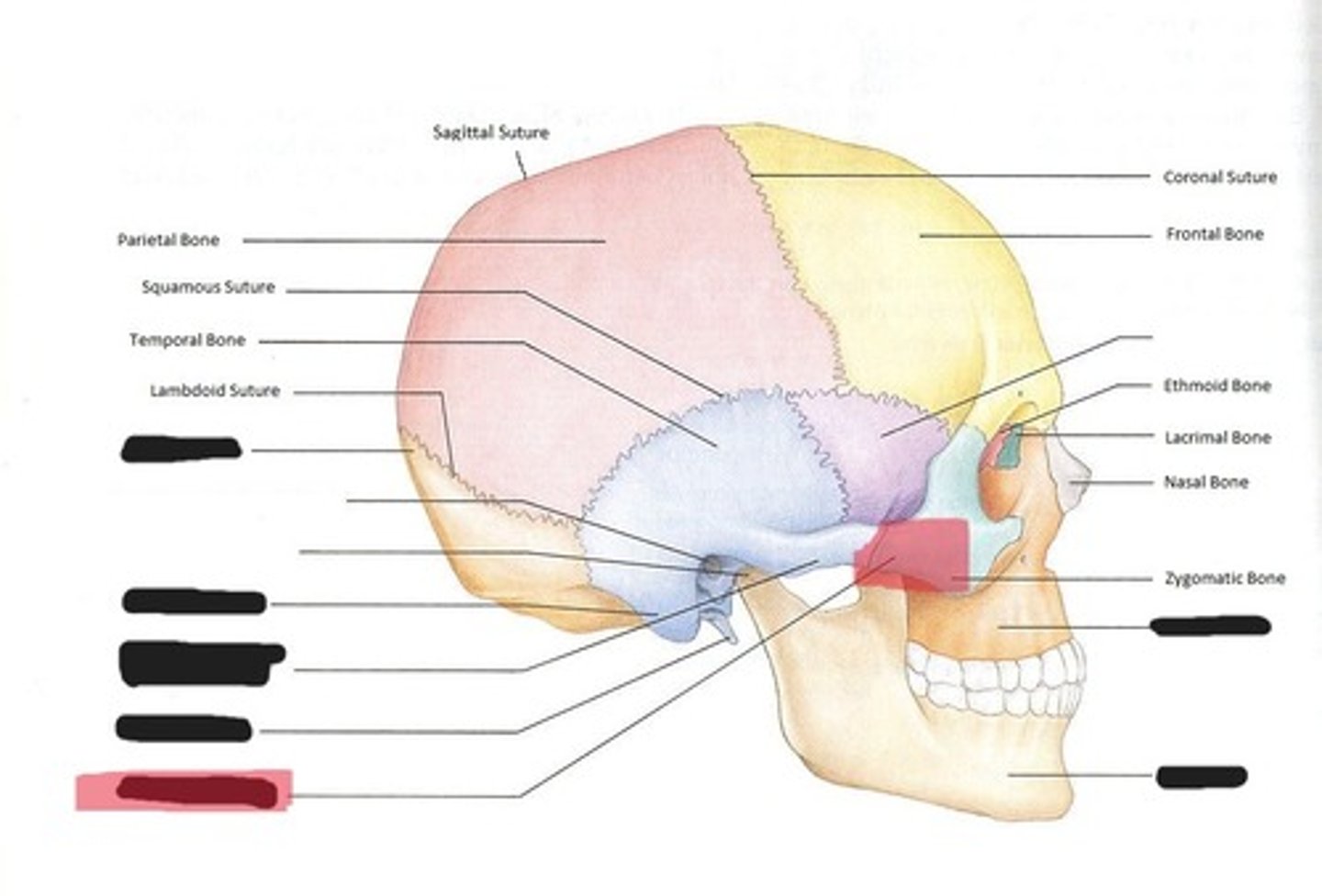 <p>Temporal process of the Zygomatic bone</p>