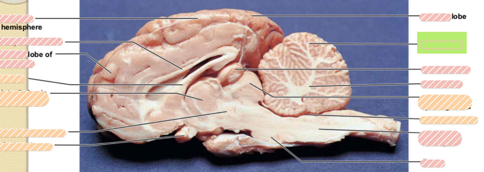 <p><span>Sheep brain</span></p>