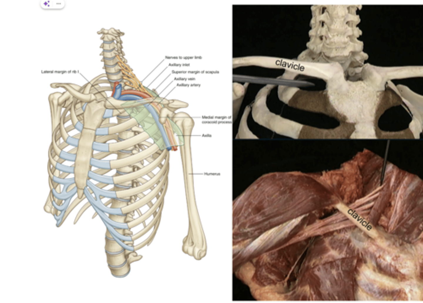 <p>Costoclavicular space</p>