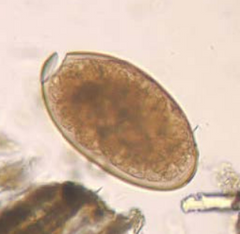 <p>Cap on the end of fluke eggs</p>