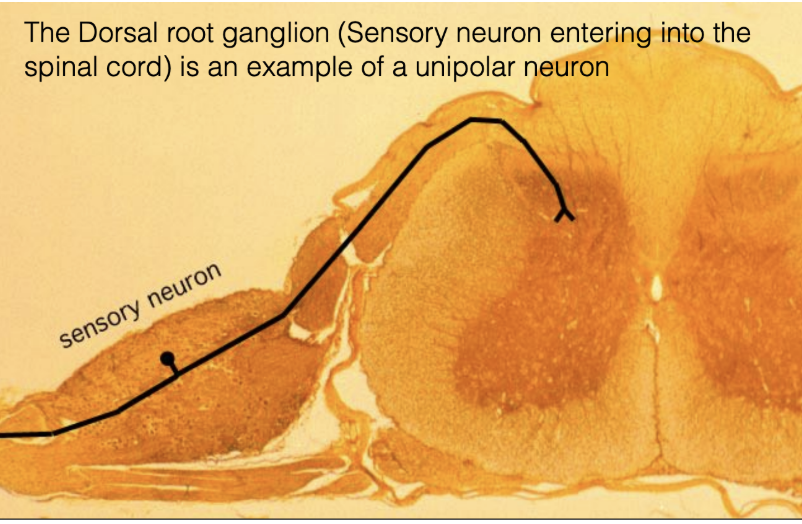 <ul><li><p>The dorsal root ganglion (sensory neuron entering into the spinal cord) is an example of a unipolar neuron</p></li><li><p><span style="background-color: transparent;"><span>Unipolar neurons have one cell body with a single extension from it and then two branches off of that extension</span></span></p><ul><li><p><span style="background-color: transparent;"><span>One has to be axon and a dendrite, sending information to and from different areas</span></span></p></li></ul></li></ul><p></p><ul><li><p></p></li></ul><p></p>