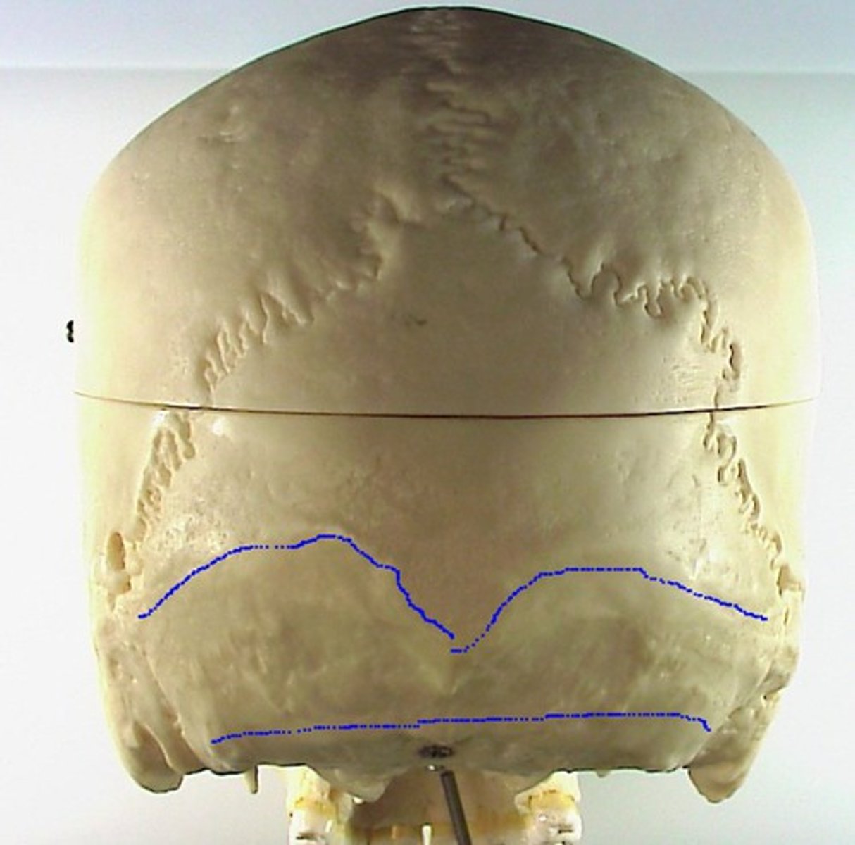 <p>extend laterally from the external occipital protuberance</p>