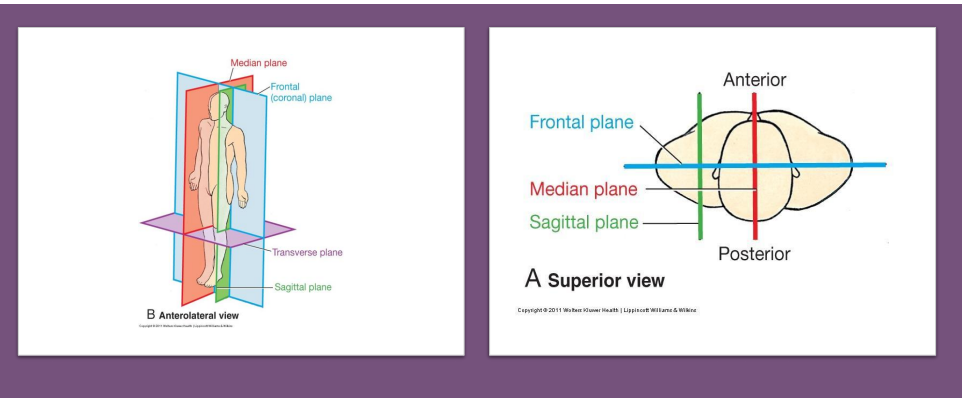 <p>DIAGRAM ON SLIDE 5</p>