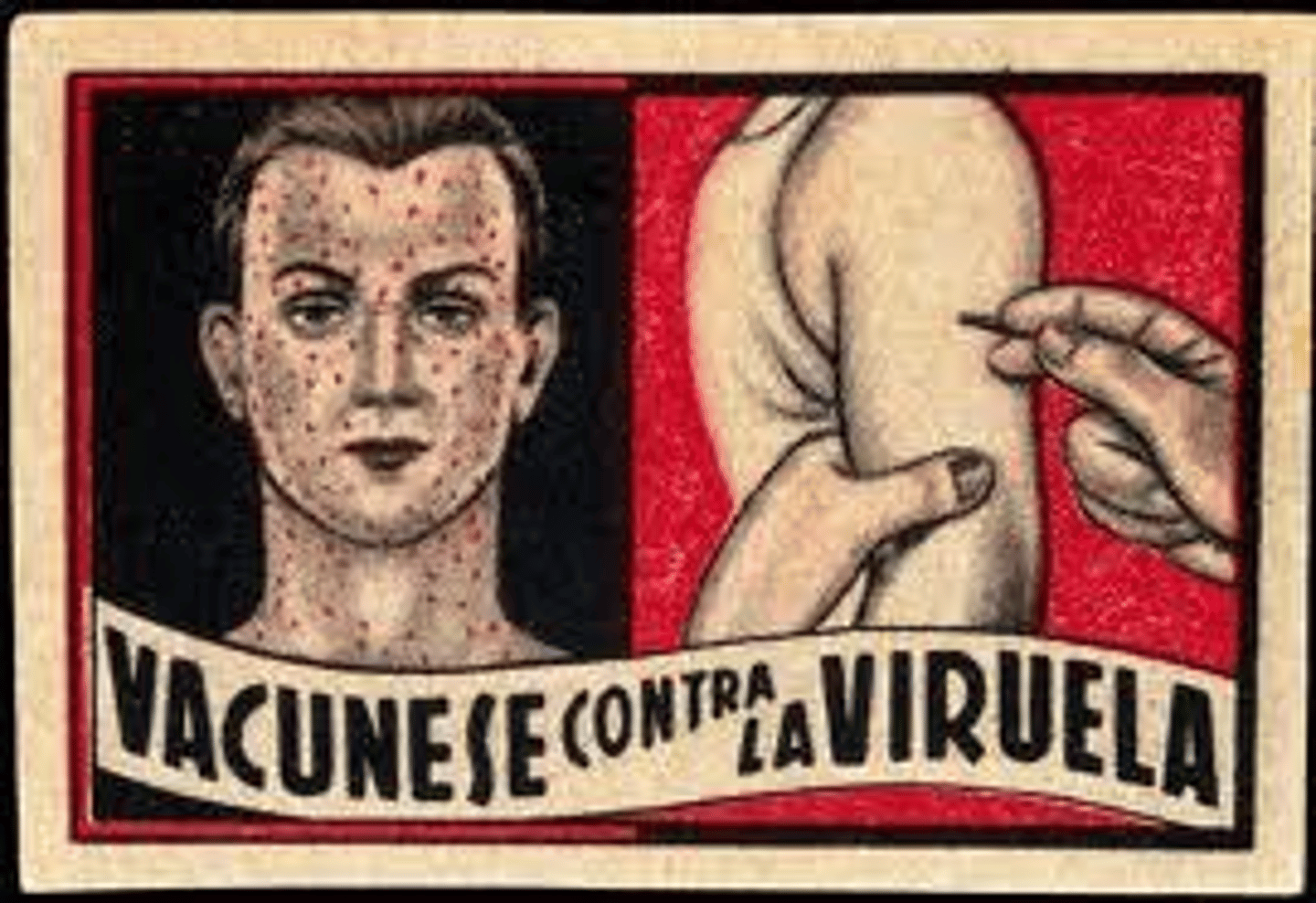 <p>Edward Jenner in 1796.</p>