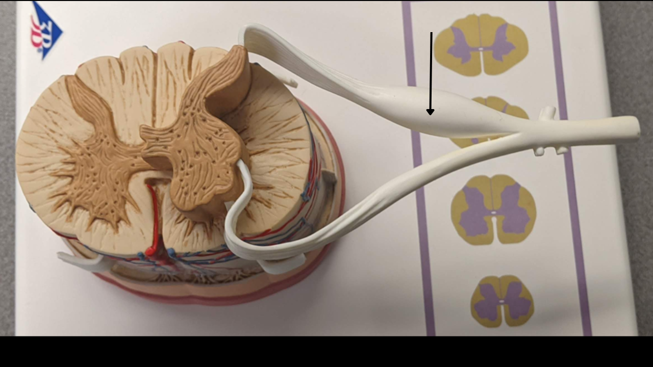 <p>Dorsal root ganglion </p>
