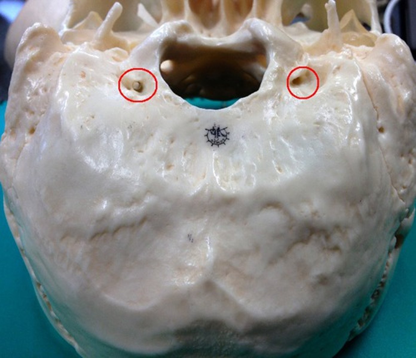 <p>what passes through this structure?</p>